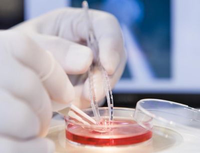 In einem Labor steht eine Petrischale mit roter Flüssigkeit unter einem Mikroskop. Zwei Hände einer Person, die mit Handschuhen bekleidet sind, bewegen mit zwei Pinzetten den Inhalts der Patrischale.